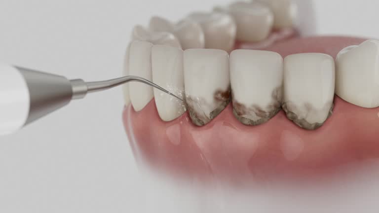 Trusted Dental Crowns And Bridges service in Emporium, PA - Dentist Open Now